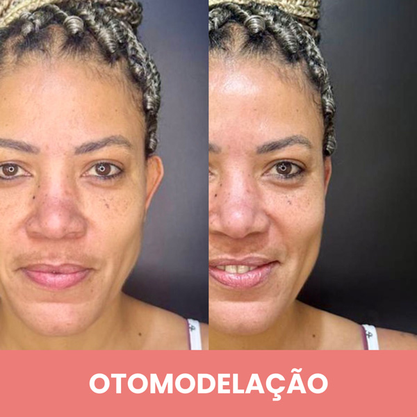 OTOMODELAÇÃO-2