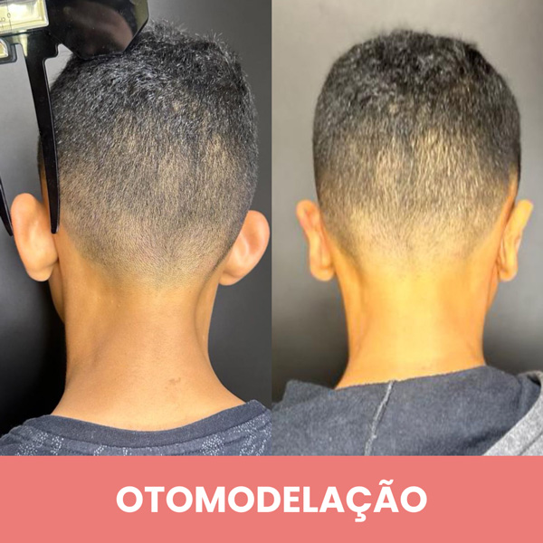 Dra. Lúcia Takenaka | Harmonização Facial em Contagem — Otomodelação ...