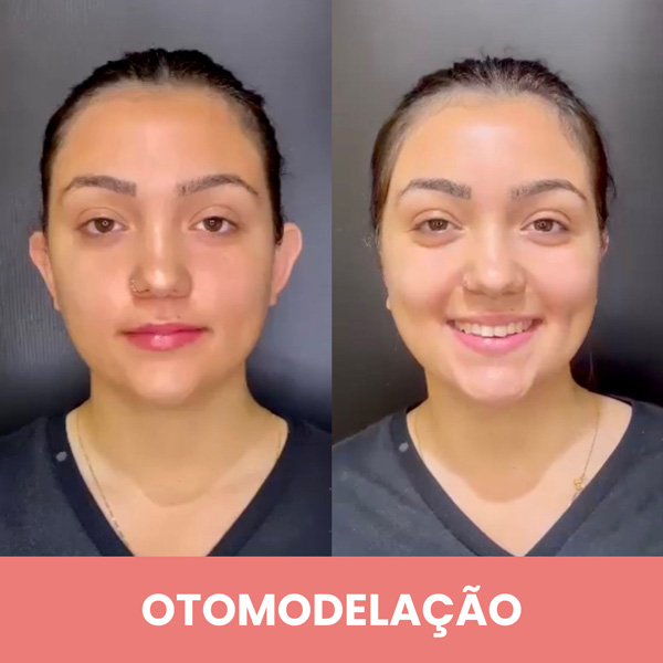 Dra. Lúcia Takenaka | Harmonização Facial em Contagem — Otomodelação ...